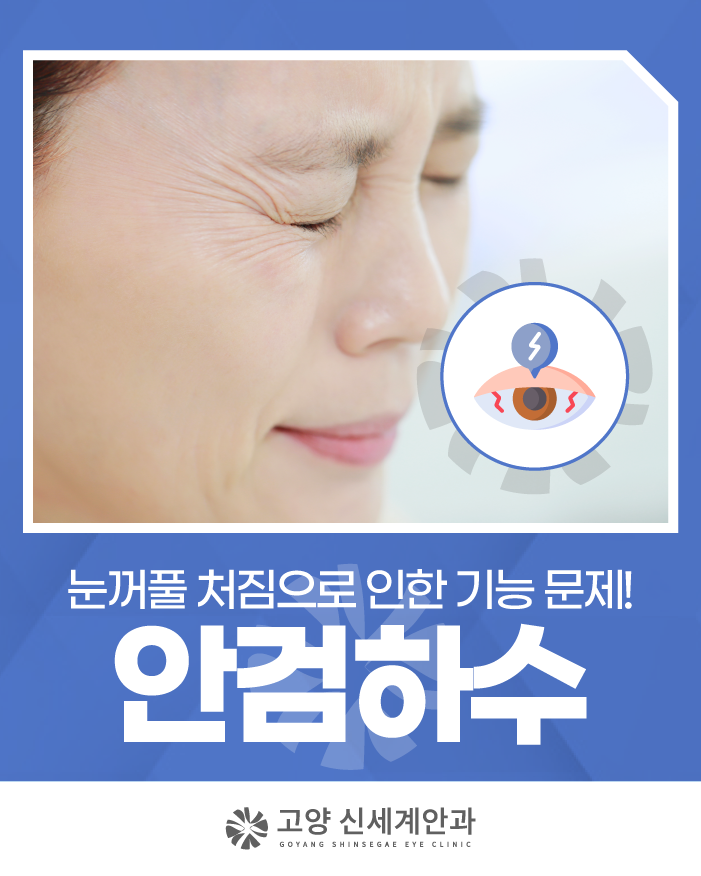 고양 안검하수안과, 눈이 자꾸 무겁고 피곤하다면?