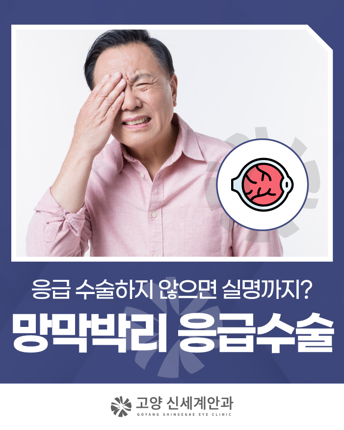 고양안과, 망막박리 응급수술하는 곳을 찾는다면?