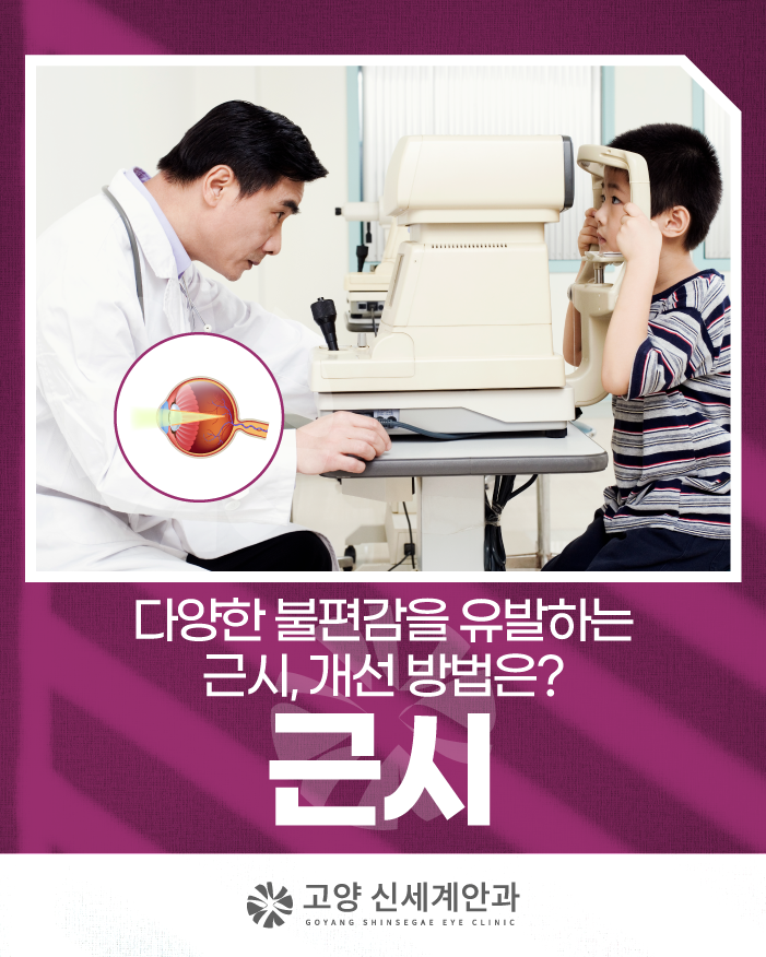 고양신세계안과, 근시는 어떤 질환일까?