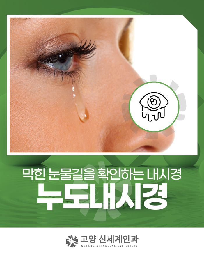 고양 누도내시경 치료과정이 궁금하다면?